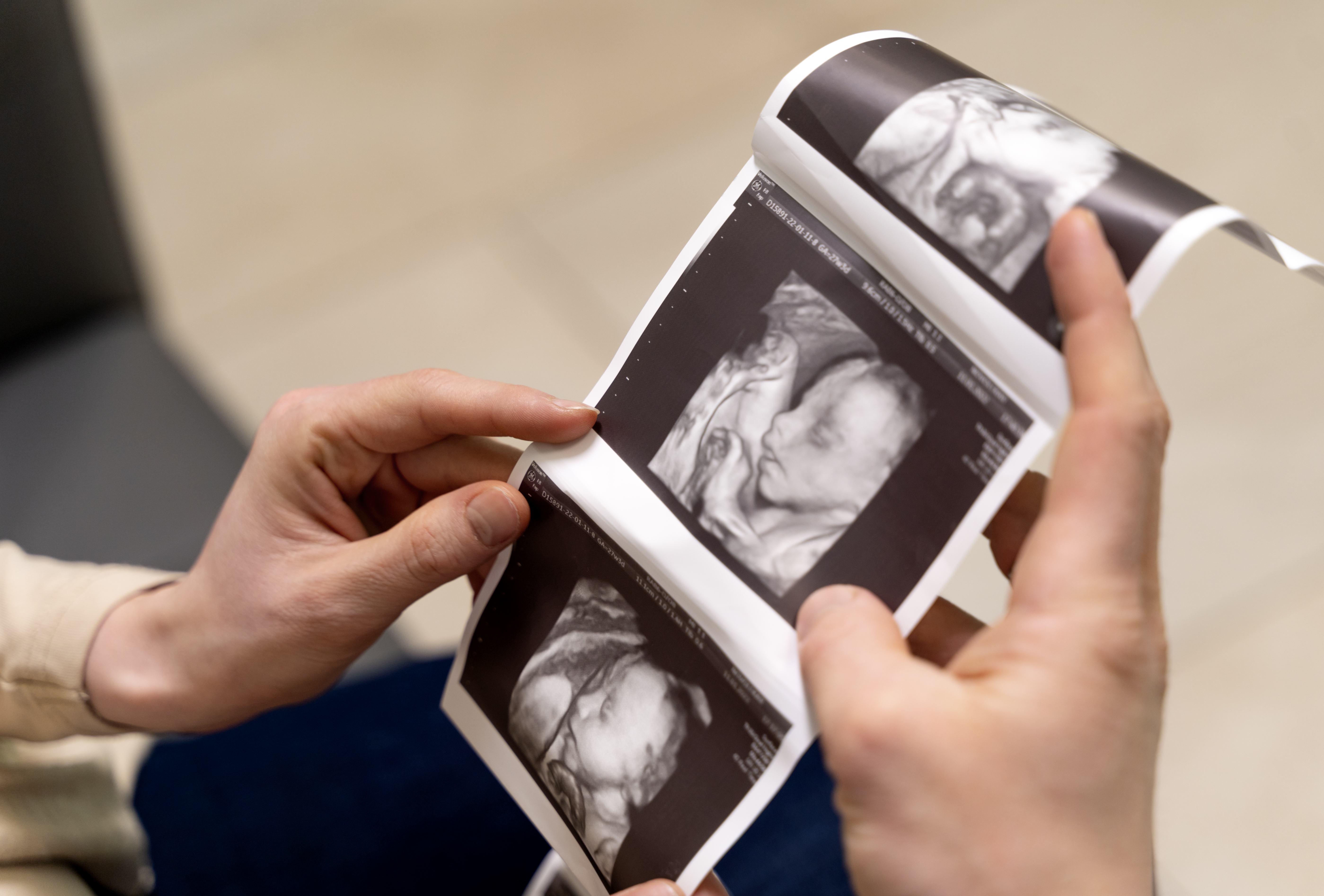 3D/4D Obstetric Scan in OMR