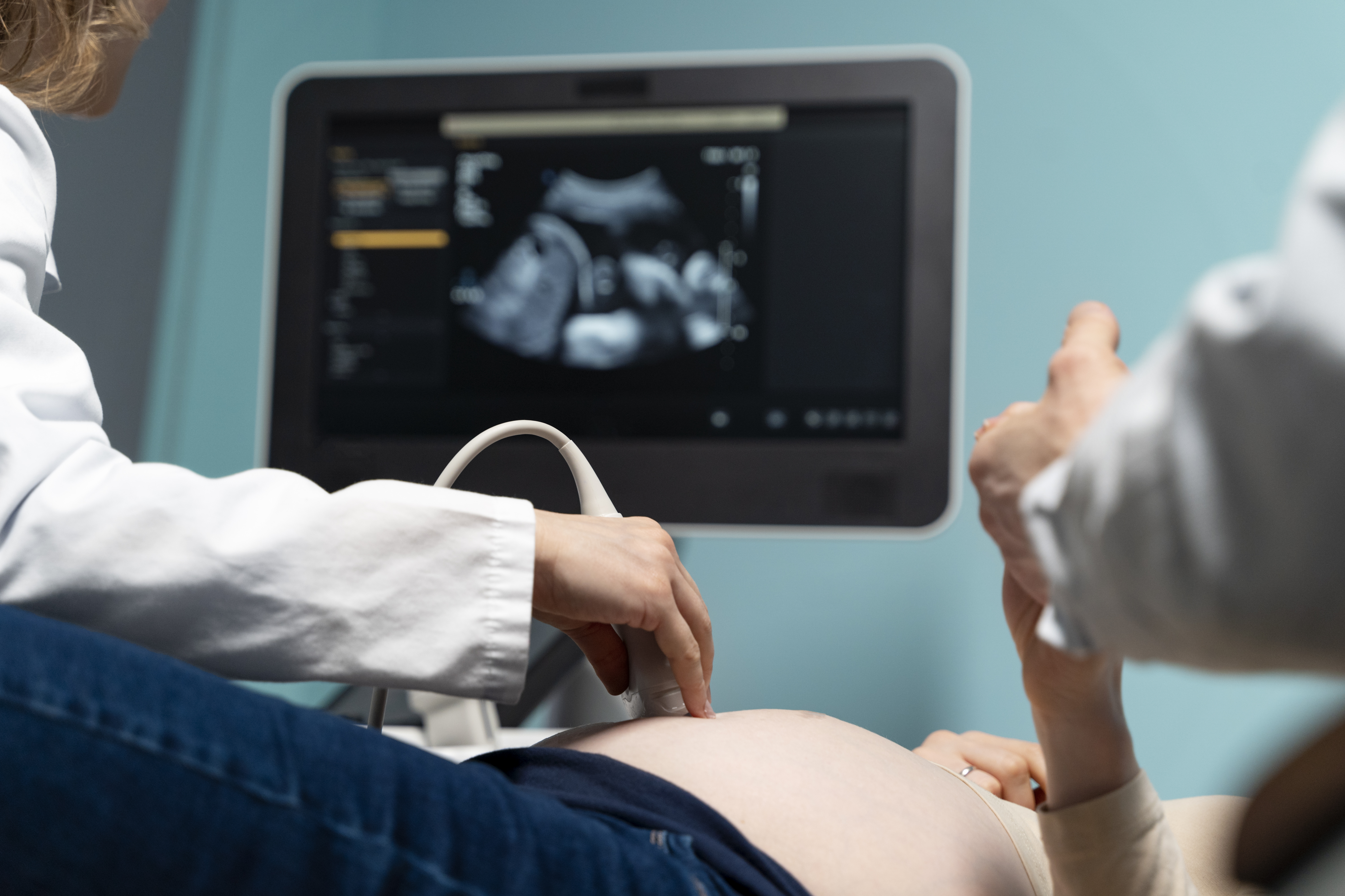 4D Pregnancy Ultrasound Scan
