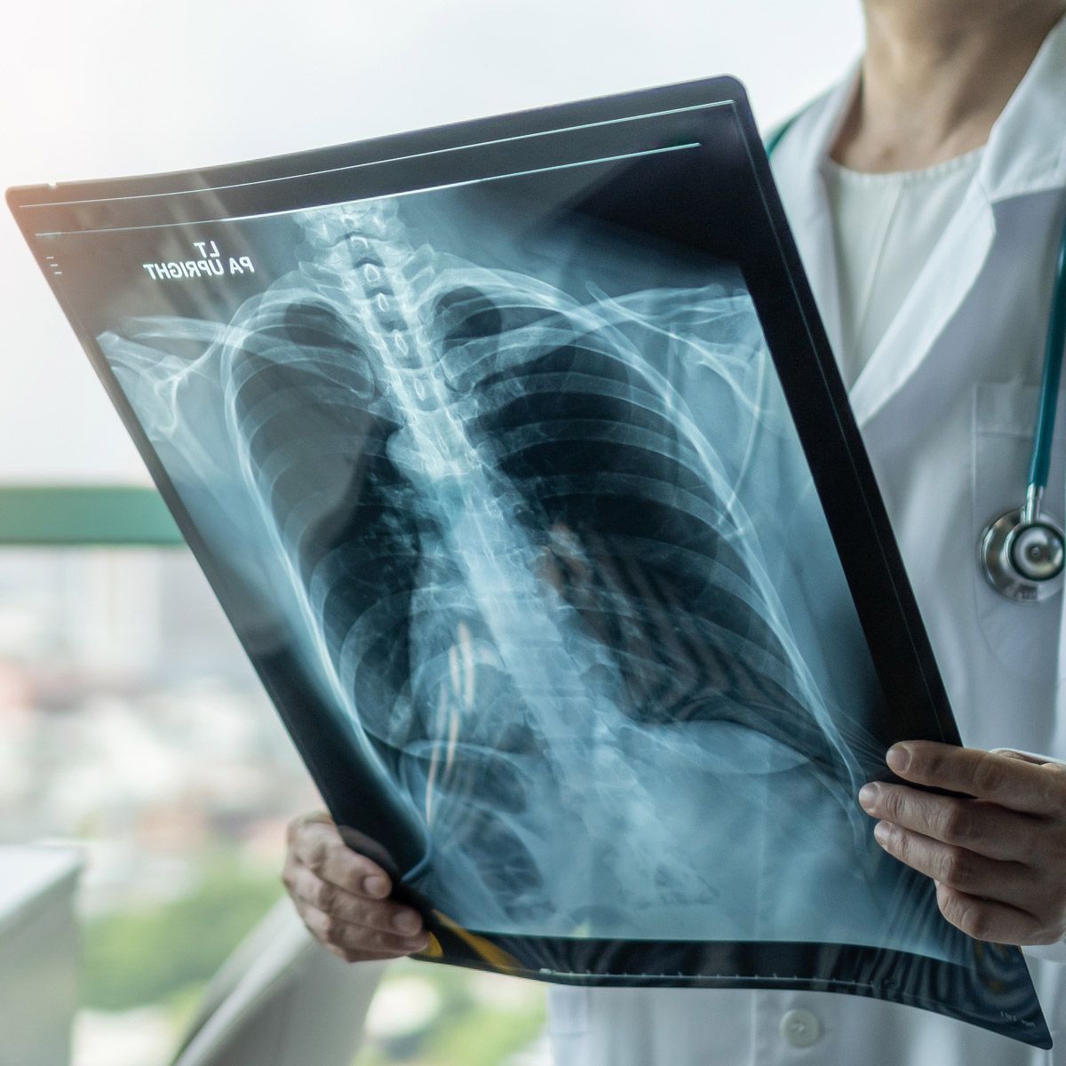 CT Scan in Padur
