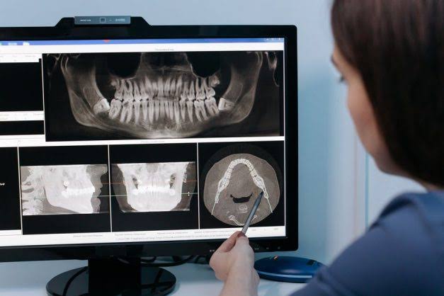 OPG X-Ray examination at AVR Scan Centre Sholinganallur