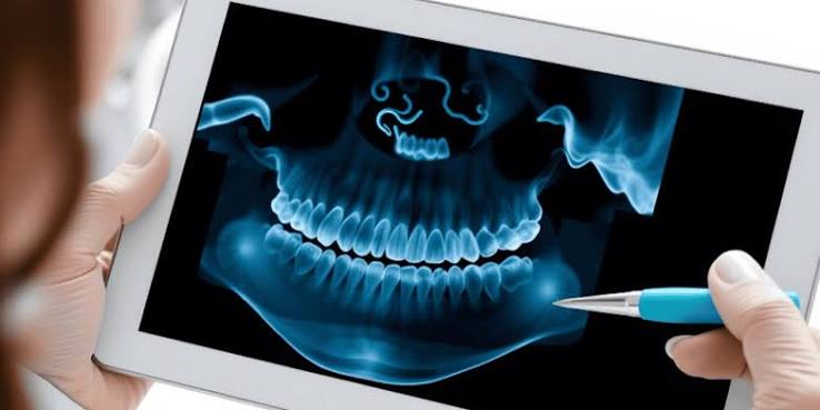 OPG X-Ray in Sholinganallur