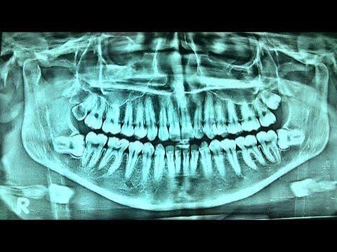 OPG X-Ray in Padur